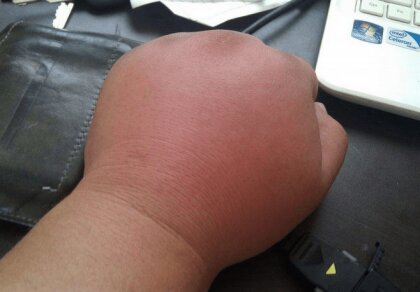 펼치는 손가락으로 알아보는 연애 스타일 심리테스트